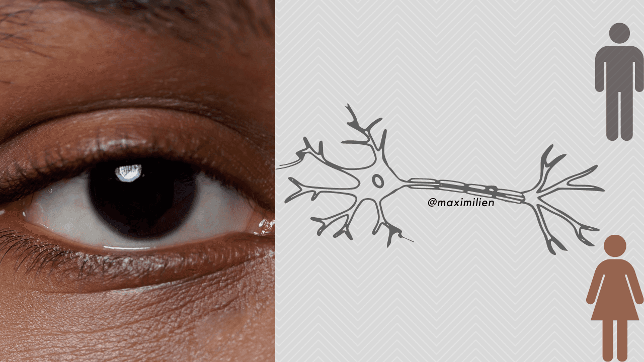 End-To-End Gender Determination by Morphometry of Eyes using CNN (Convolutional Neural Network)